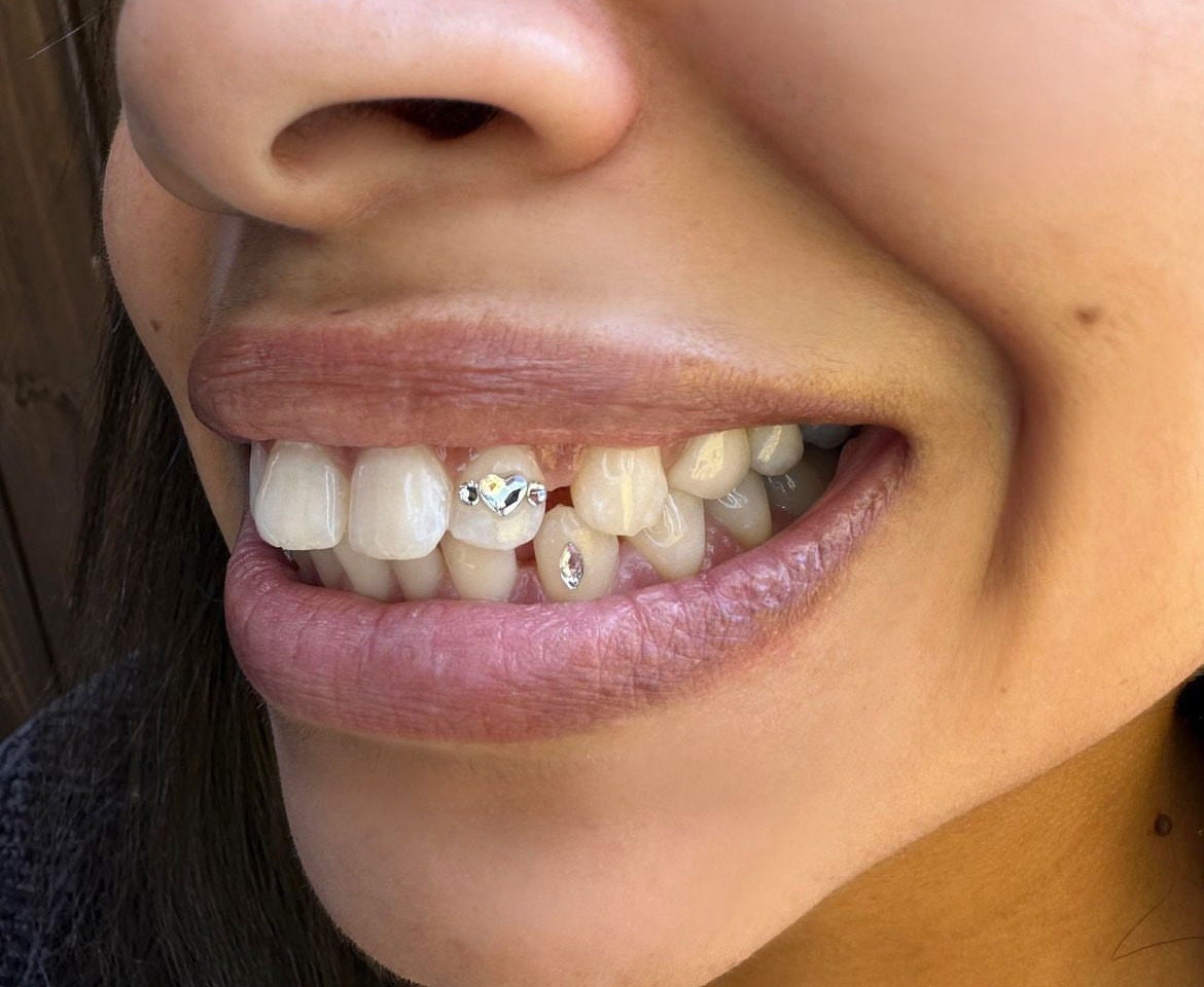 Heart Braces Swarovski Tooth Gem Kit | DIY Set