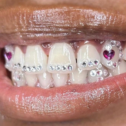 Heart Braces Swarovski Tooth Gem Kit | DIY Set